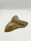 New Tooth 9